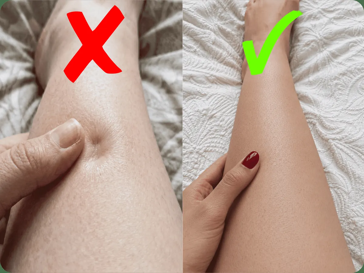 The thumb test: a dent that stays versus skin that bounces back